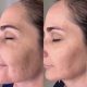 Dispositivo Hexibella MicroGlow