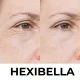 Hexibella Red Light Device