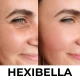 Hexibella Red Light Device