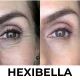 Hexibella Red Light Device