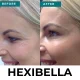 Hexibella Red Light Device