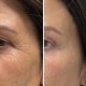 Siero al rame peptide Hexi