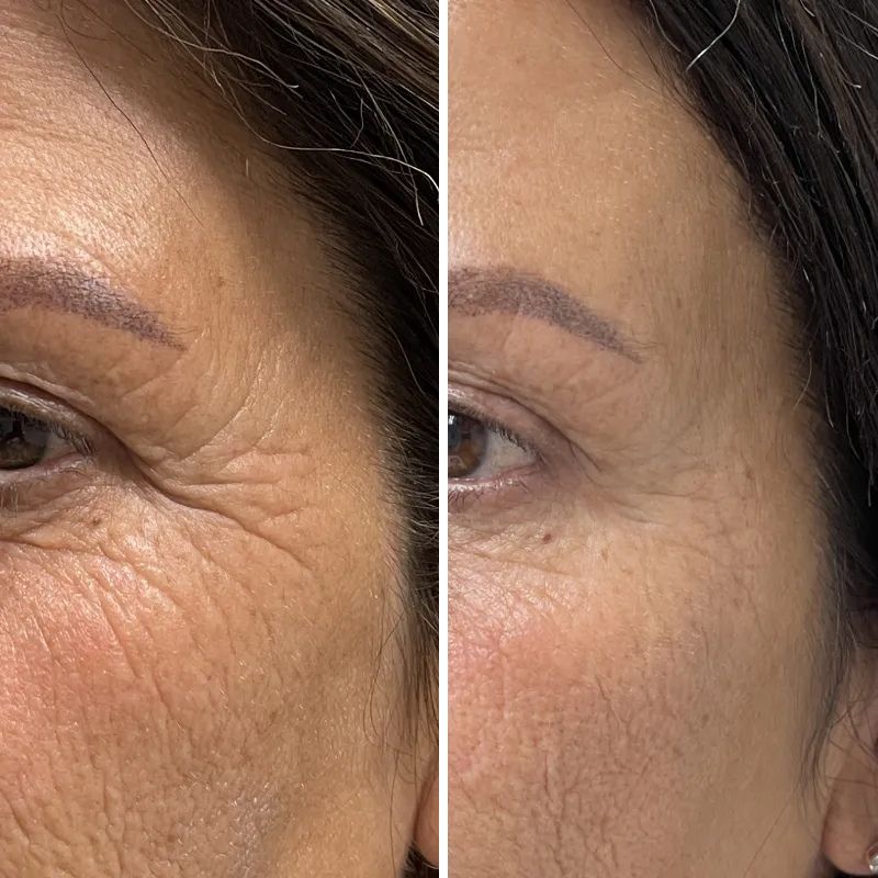 Copy of Hexibella - Serum (1) Hexi Copper Peptide Serum
