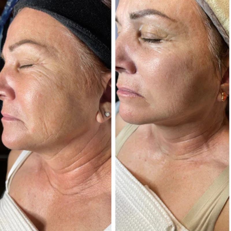 Copy of Hexibella - Serum (3) Hexi Copper Peptide Serum