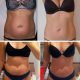 Hexi Body Toner