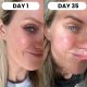 Red Light Therapy Set