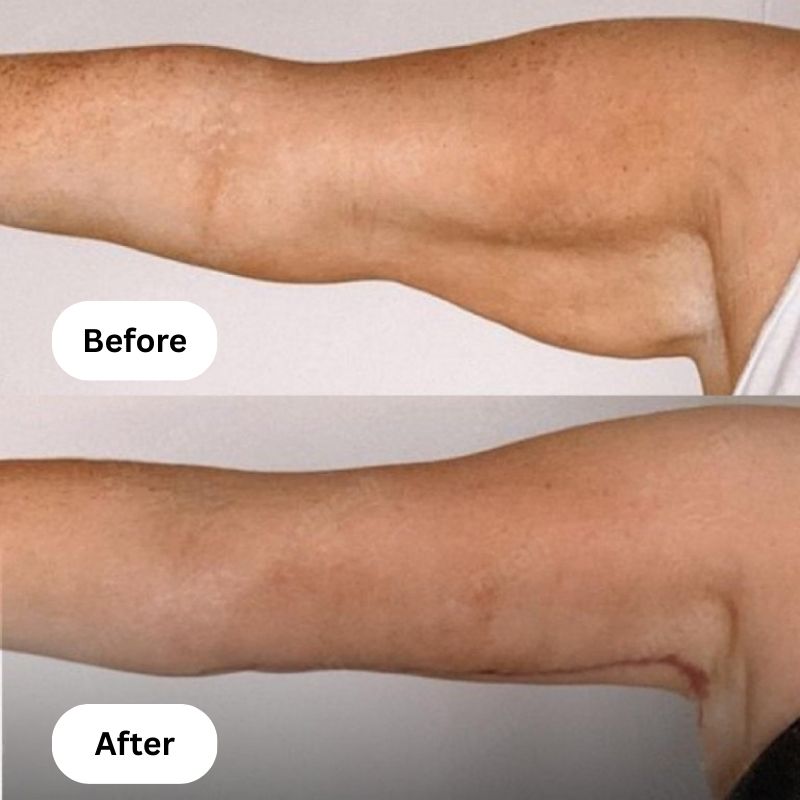Copy of Copy of BVSA (4) Hexi Body Toner