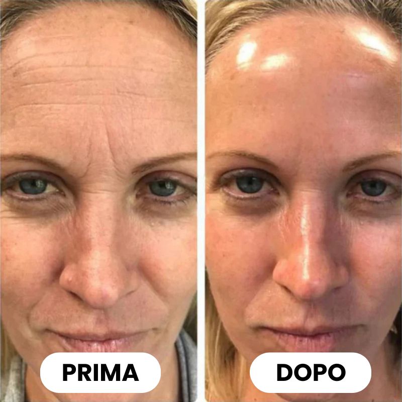 MicrosoftTeams-immagine_887 Collagen Jelly + Free Mask