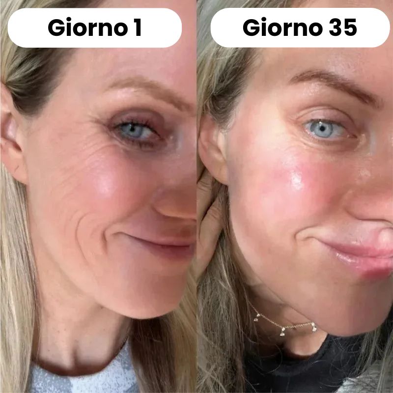 Copia di BVSA (2) Set per terapia a luce rossa