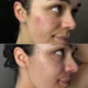 Revolution LED Mask